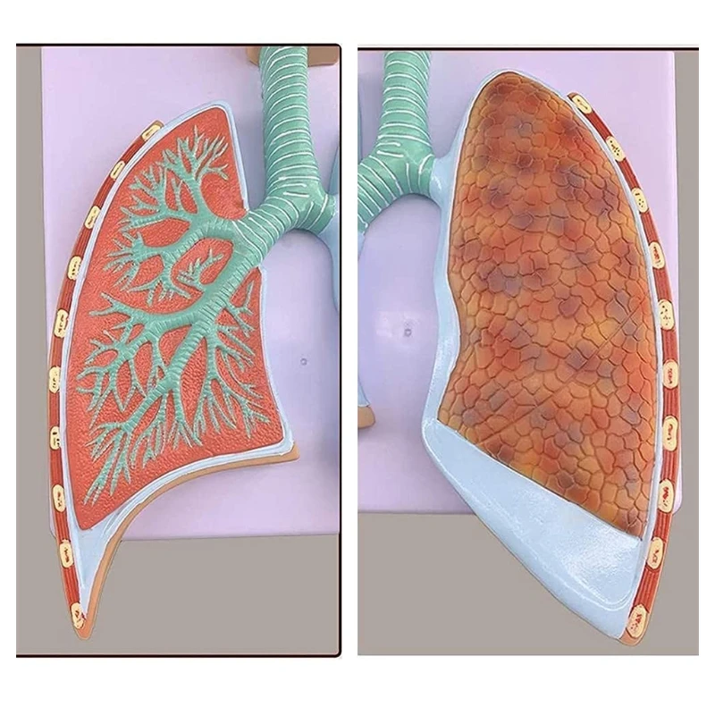 Многоцелевая модель анатомического строения дыхательной системы человека, увеличенная модель альвеолярного отростка человека для больницы, школьного челнока